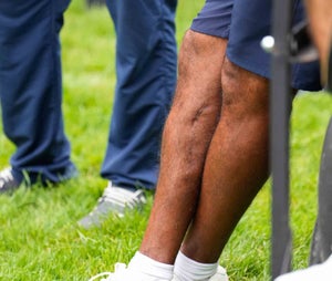 What does Tiger Woods’ injured right leg look like? New photos show scars