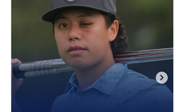 Golf prodigy Jeffrey Guan, 20, blinded in one eye after freak accident at pro-am